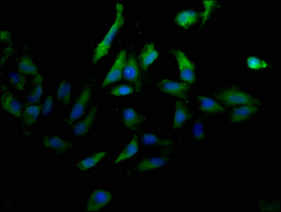 CD31 Monoclonal Antibody