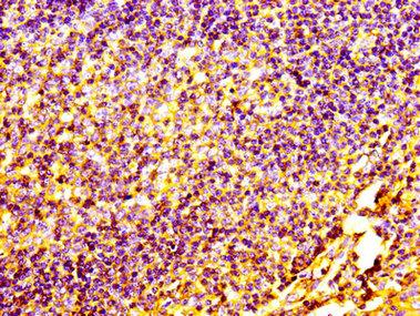 CD31 Monoclonal Antibody