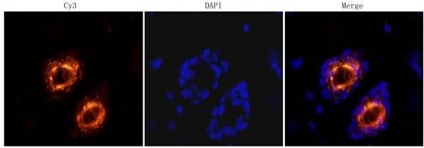 CD31 antibody