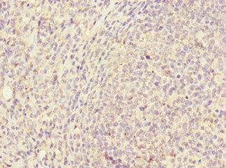 CD320 antibody