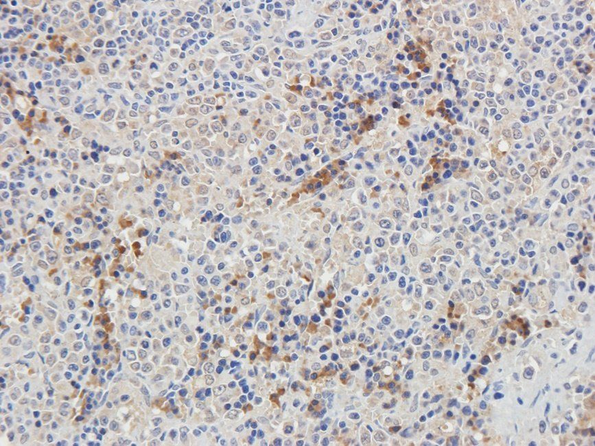 CD32b antibody