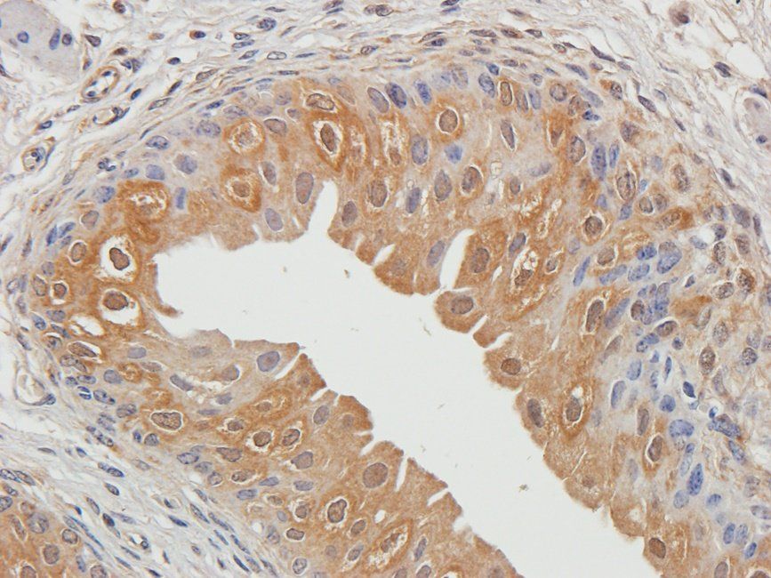 CD32b antibody