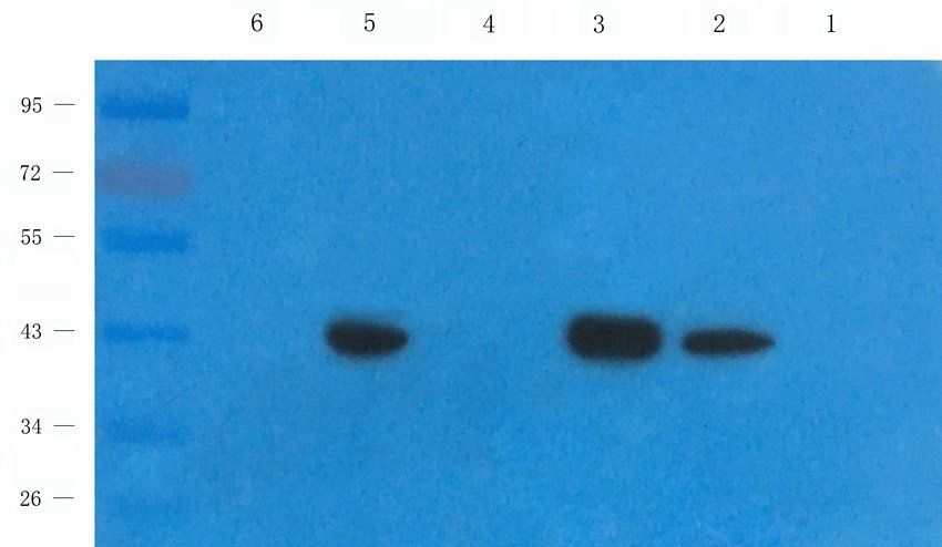 CD32b antibody