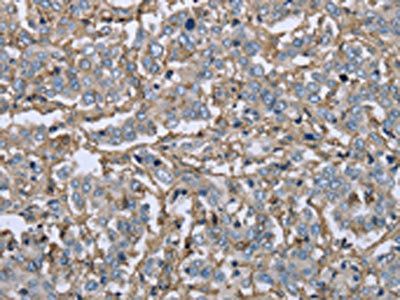 FCGR2B Antibody