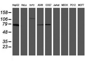 CD33 Antibody