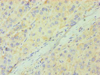 CD33 Antibody