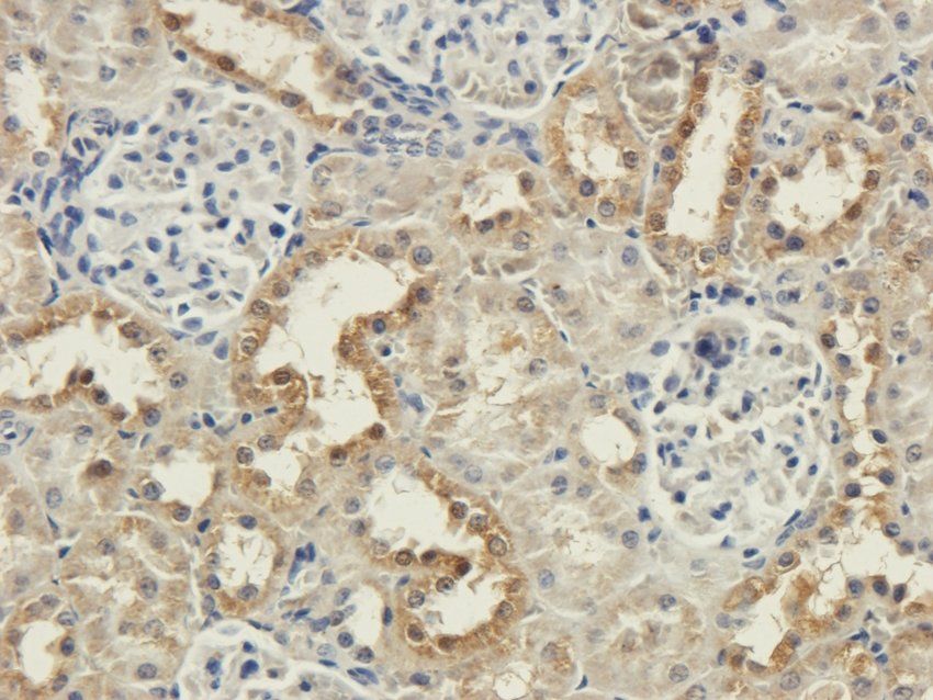CD333 antibody