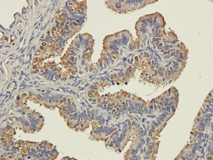 CD333 antibody