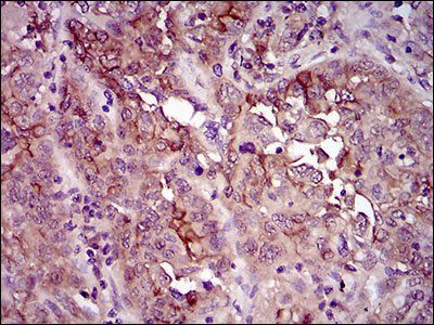 CD33 Antibody