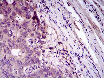 CD33 Antibody