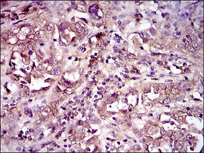 CD33 Antibody