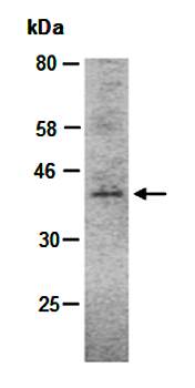 CD33 (C2) Antibody, Rabbit Polyclonal