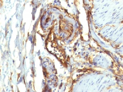 CD34 (Hematopoietic Stem Cell & Endothelial Marker) Antibody
