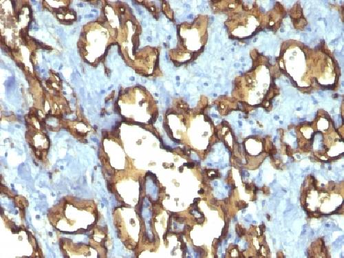 CD34 (Hematopoietic Stem Cell & Endothelial Marker) Antibody