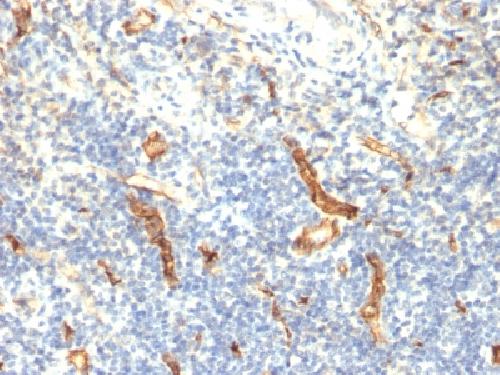 CD34 (Hematopoietic Stem Cell & Endothelial Marker) Antibody