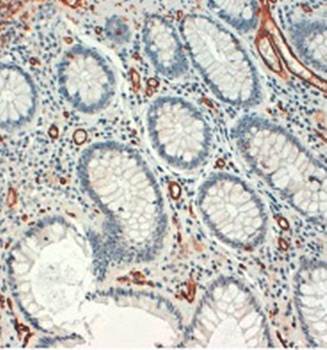 CD34 Monoclonal Antibody