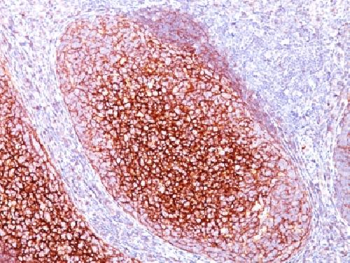 CR1 Antibody