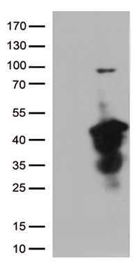 CR1 Antibody