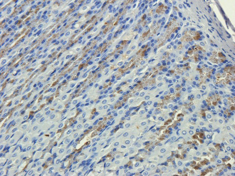 CD35 antibody