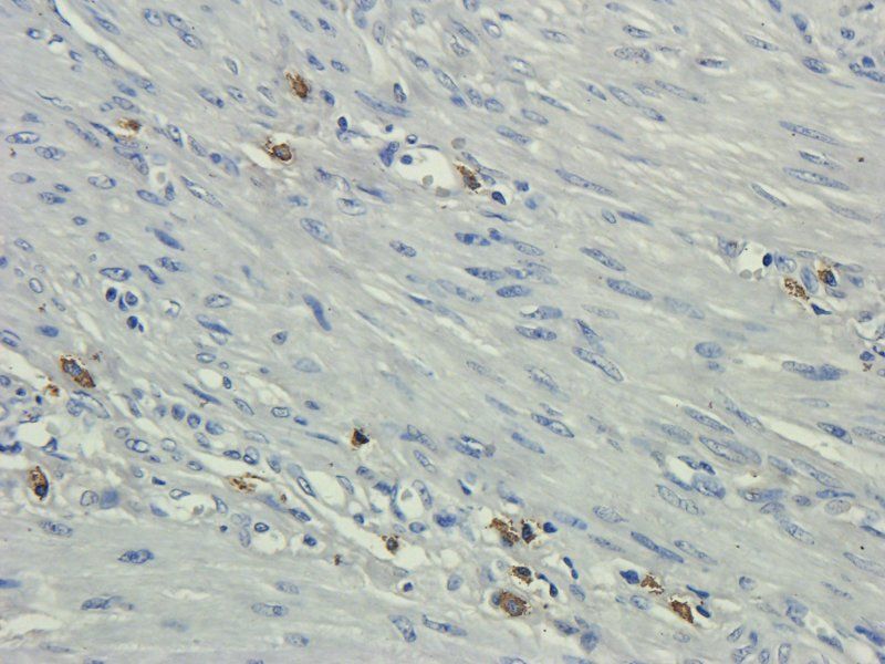 CD35 antibody