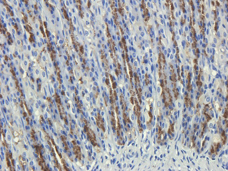 CD35 antibody