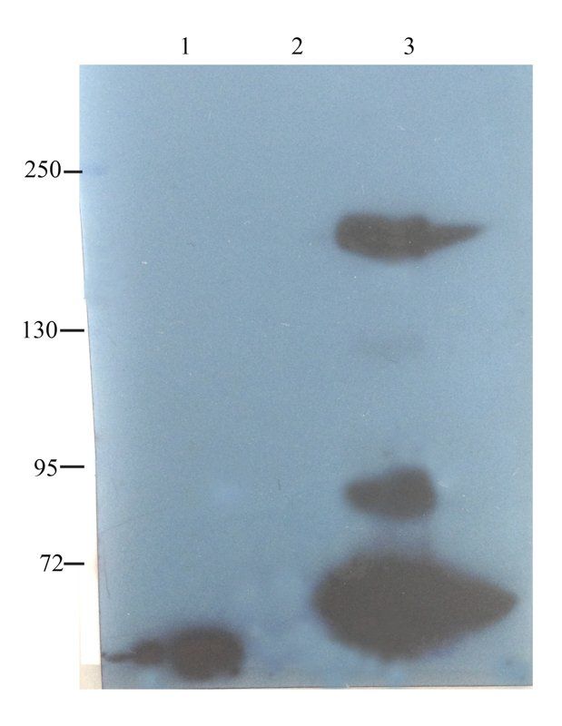 CD35 antibody