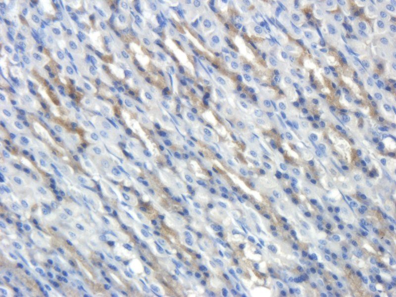 CD35 antibody