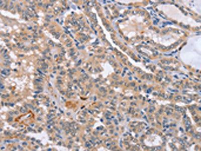 CD36 Antibody