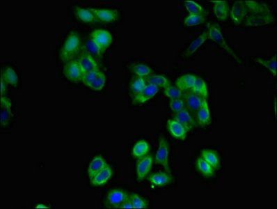 CD36 Antibody