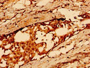 CD36 Antibody
