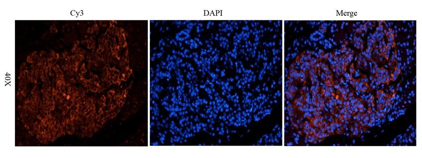 CD38 antibody