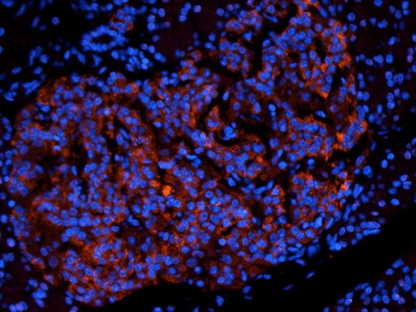 CD38 antibody