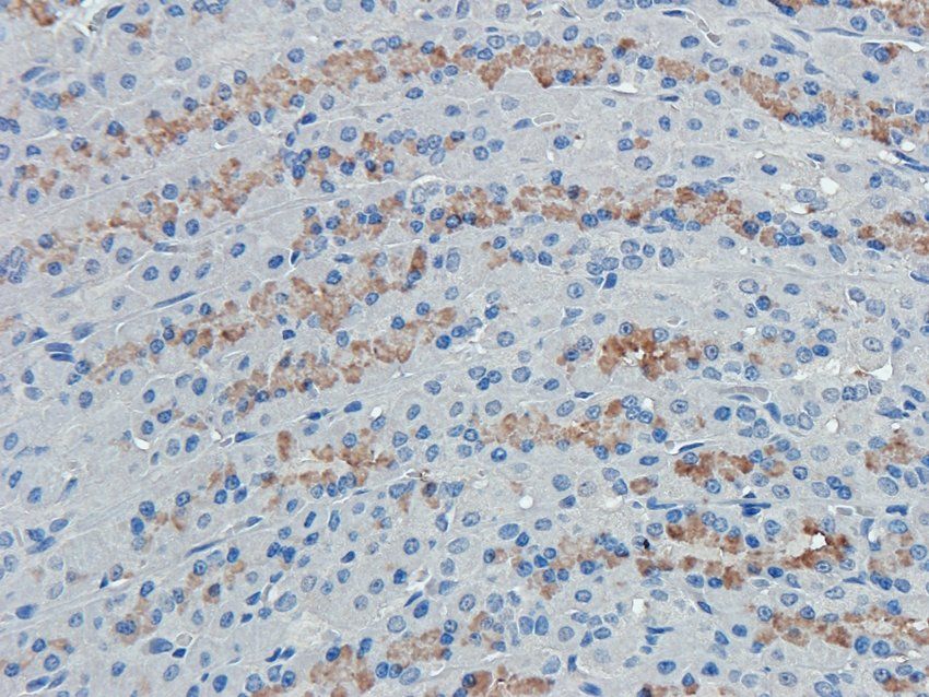 CD38 antibody