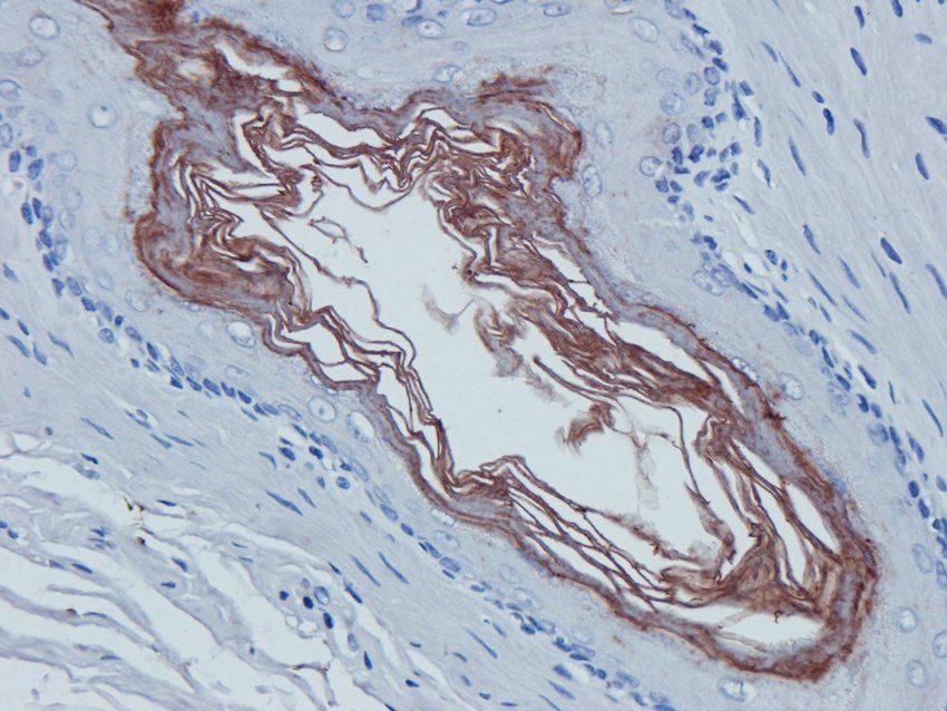 CD38 antibody