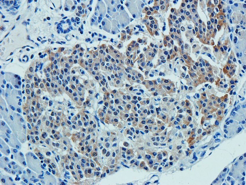 CD38 antibody