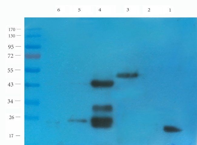 CD38 antibody