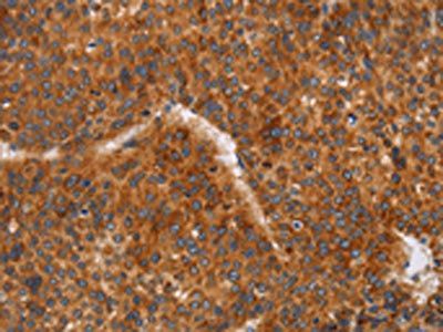 CD38 Antibody