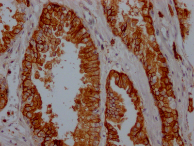 CD38 Recombinant Monoclonal Antibody