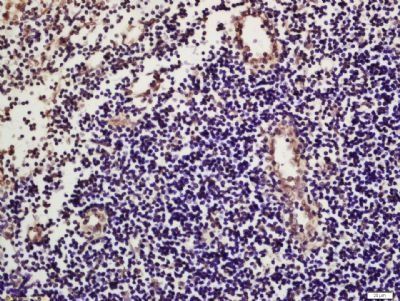 ENTPD1/CD39 Rabbit Polyclonal Antibody