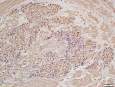 ENTPD1/CD39 Rabbit Polyclonal Antibody