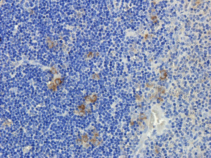 CD3 antibody