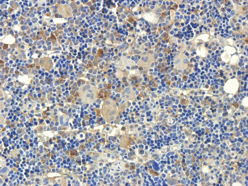 CD3 antibody