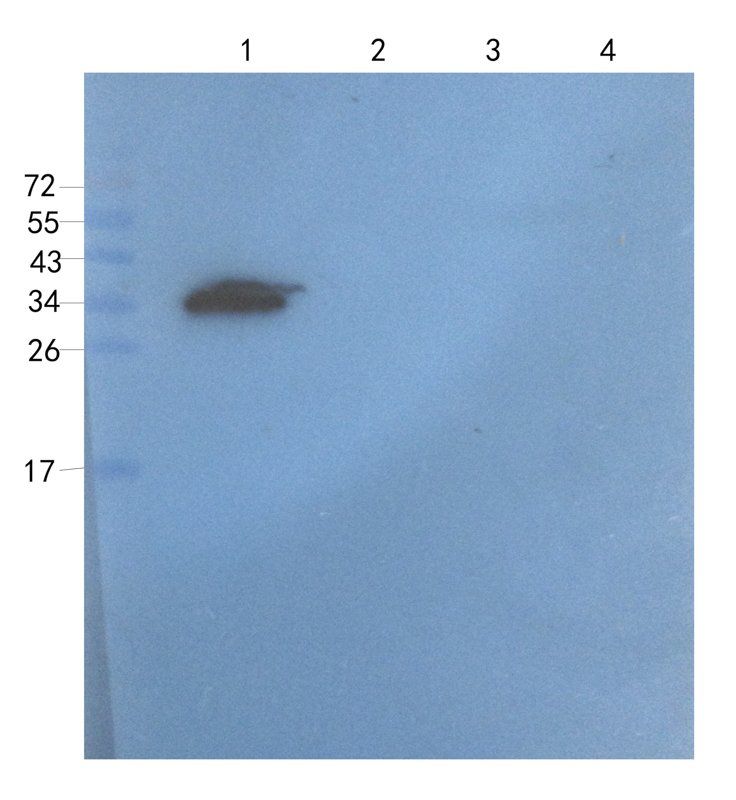 CD3 antibody