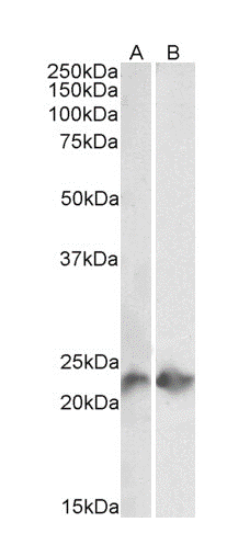 CD3 epsilon antibody