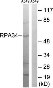 CD3EAP Antibody
