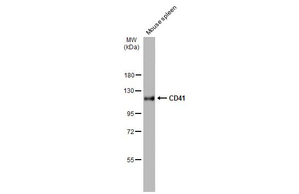 integrin subunit alpha 2b Antibody
