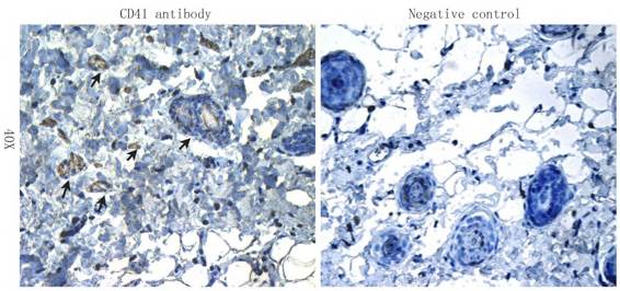 CD41 Antibody