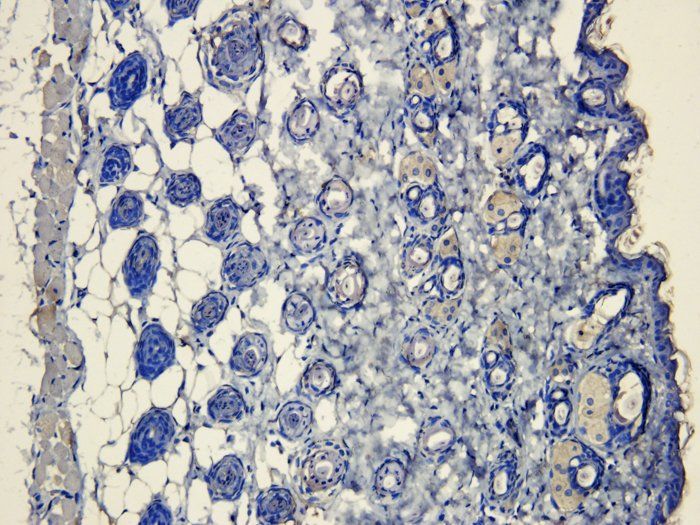 CD41 Antibody