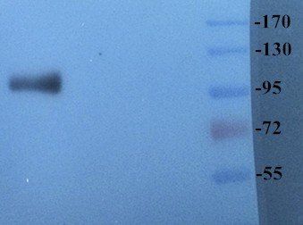 CD41 Antibody