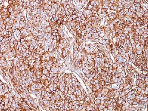 CD44 Antibody